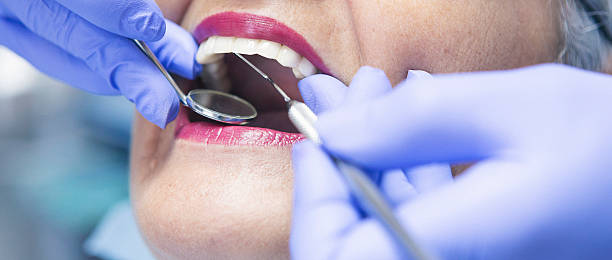 Best Emergency Treatment for Dental Infections or Abscesses in Altamonte Springs, FL